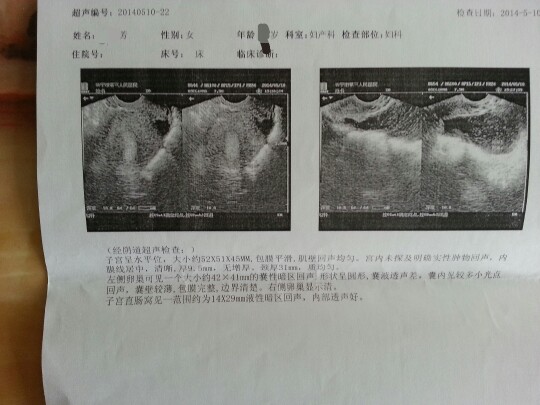 为什么会盆腔积液是怎么引起的（盆腔积液是怎么引起的）