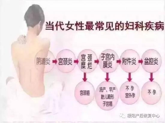女性妇科炎症有哪些症状图片大全（女性妇科炎症有哪些症状）