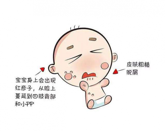 过敏性红疹子图片小孩（过敏性红疹子图片）