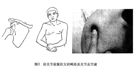 阳性的11个表现腹泻（阳性的11个表现）