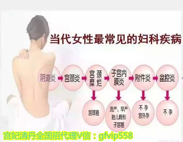 15种常见的妇科疾病手术（15种常见的妇科疾病）