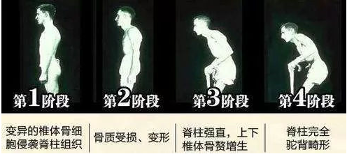 男性性疾病初期症状腿部（男性性疾病初期症状）