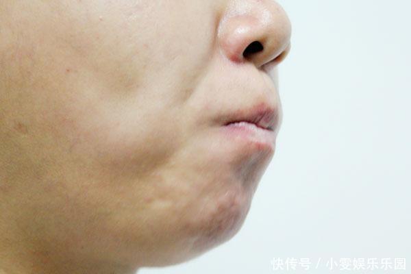 吃维生素b2多久乳房会变大（下边干涩吃维生素b2管用吗）