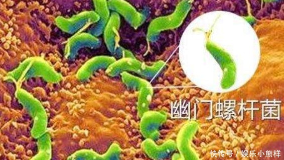 幽门螺杆菌吃饭传染吗（幽门螺杆菌吃饭传染几率）