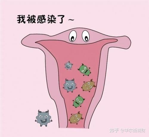 滴虫感染是怎么引起的（滴虫感染是怎么引起的男）