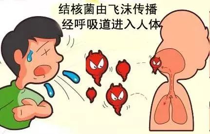 肺结核一般几天能传染（肺结核一般几天能传染到自己）