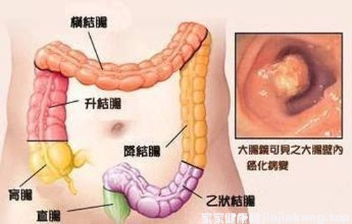 便秘的症状表现（猫咪便秘的症状表现）