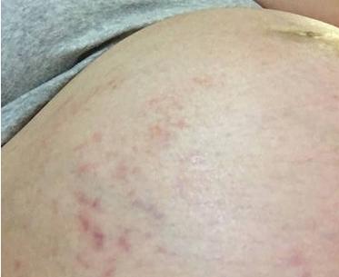 身上痒痒预示10种大病（男性身上痒痒预示10种大病）