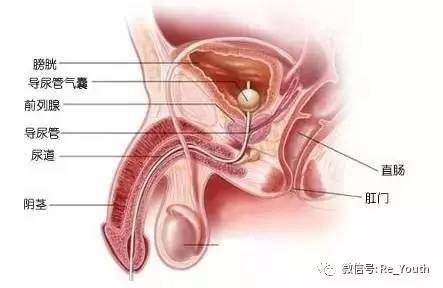前列腺肥大的自我疗法（30秒自测前列腺炎）