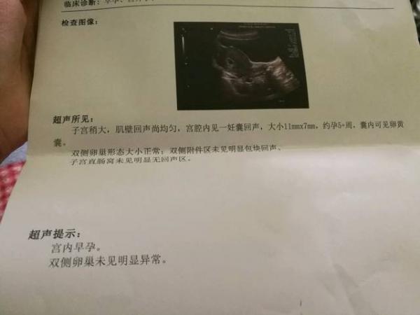 宫外孕最早几天会流血（宫外孕最早几天会流血出多久的血）