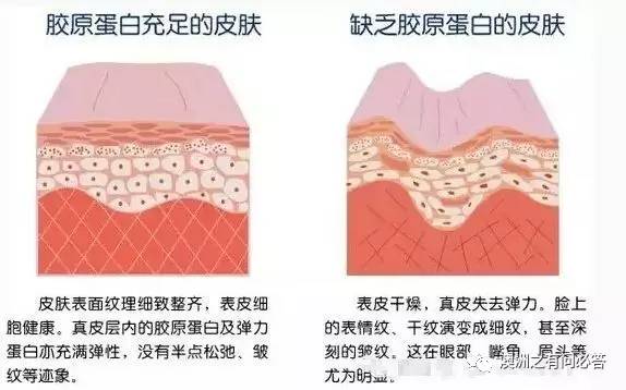 胶原蛋白真的有用吗（胶原蛋白真的有用吗）