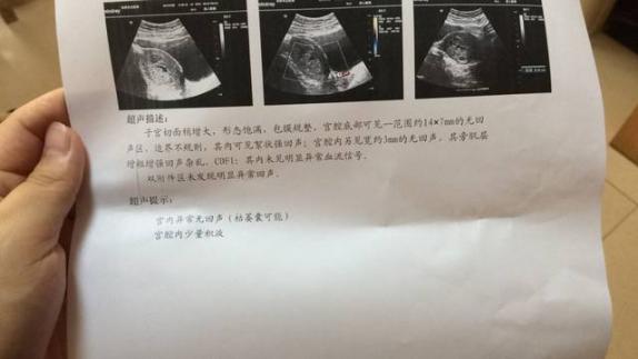 胎停有什么症状和感觉（怀孕早期胎停有什么症状和感觉）