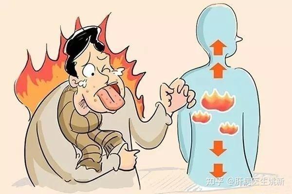 肝火旺的症状有哪些表现（肝火旺的症状有哪些表现男性）