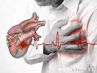 心脏问题有哪些症状（心脏问题有哪些症状表现）