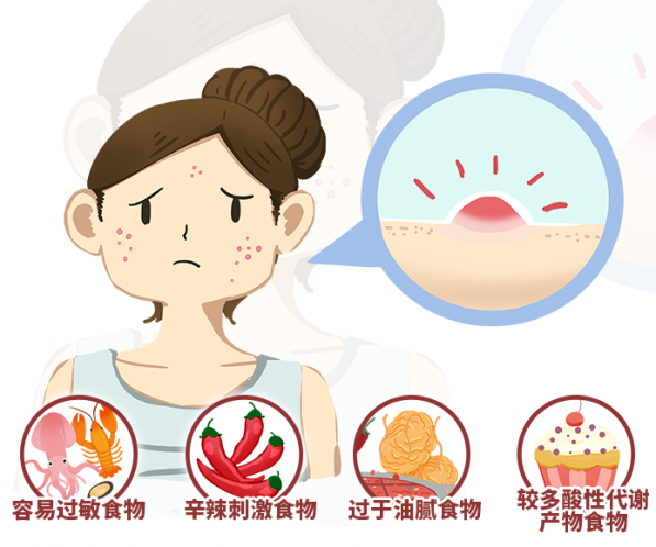 疱疹不能吃六种东西（疱疹不能吃六种东西嘴巴）