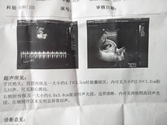 怀孕千万不要太早做b超（确认怀孕做b超需要空腹吗）
