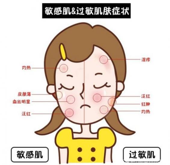 脸部皮肤过敏用什么药（脸过敏了用什么药）