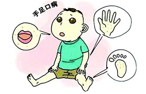 儿童口足病怎么治疗（儿童口足病怎么治疗轻微症状）