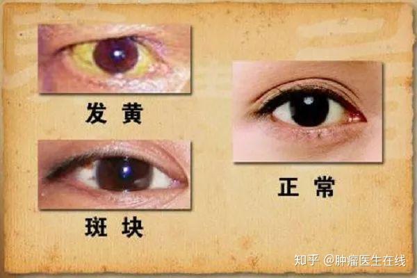 一般肝不好都有什么症状（肝不好有什么征状）