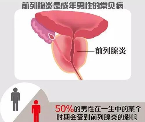 前列腺有哪些症状?（前列腺有哪些症状怎么治）