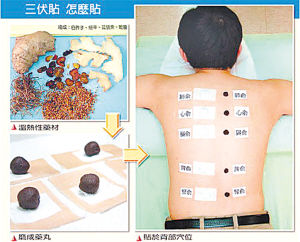三伏贴多少钱一盒（三伏贴多少钱一盒图片）