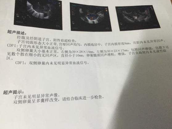 多囊卵巢拖久了会怎样（多囊卵巢综合症怎么治）
