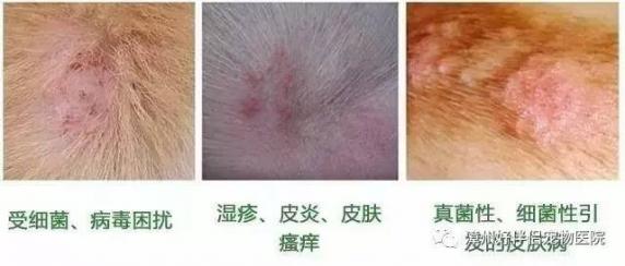 真菌性皮炎图片（真菌性皮炎图片身上）