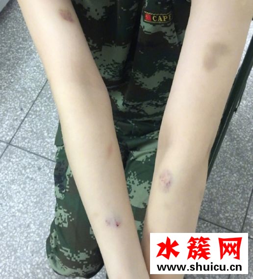 张馨予训狗惨被咬是怎么回事