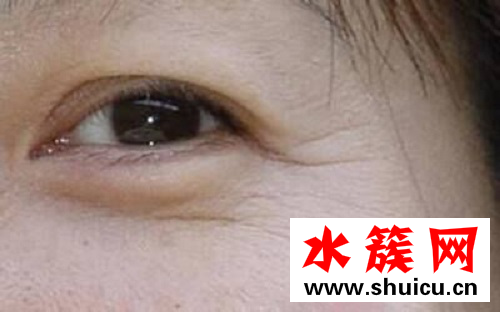 眼部皱纹用什么眼霜好 好用到哭泣的去皱眼霜