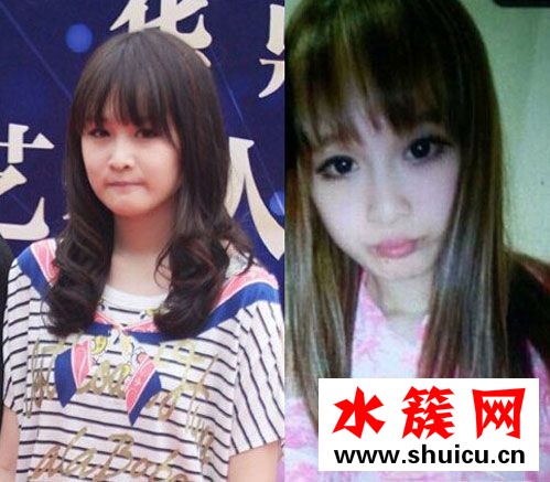 赵本山女儿球球承认整容