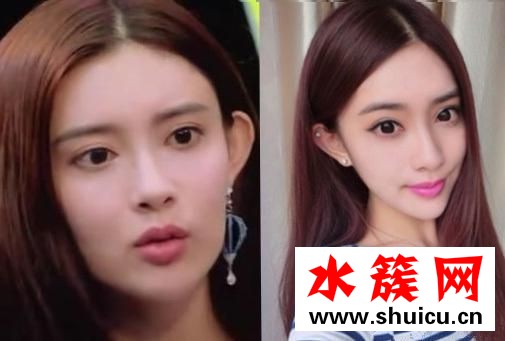 孟子义整容前后照片