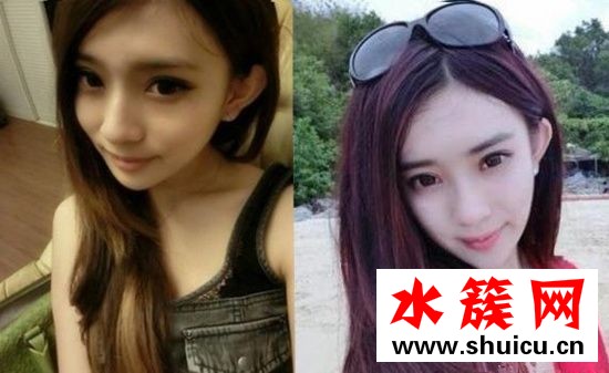 孟子义整容前后照片