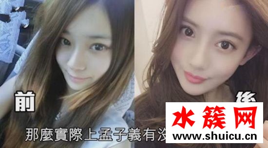 孟子义整容前后照片