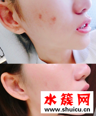 换季时刻：你有一份安瓶怎么使用方法待查收